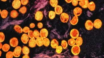 Hybrid Mpox Strain Detected in England Raises Fresh Questions for Global LGBTQ+ Health